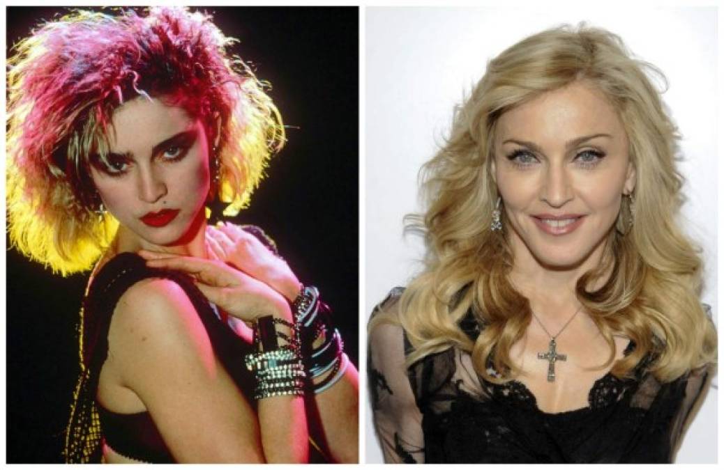 Madonna se ha hecho diversos tratamientos en su rostro.