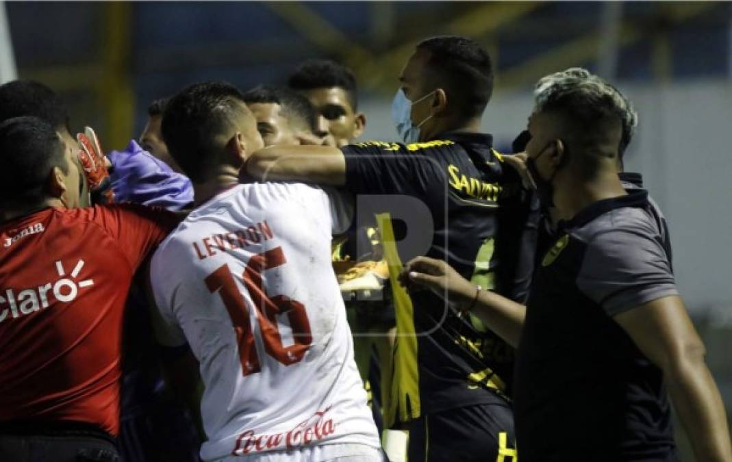 Tremendo codazo de Devron García a Johnny Leverón en el zafarrancho que se armó tras el pitazo final del partido.