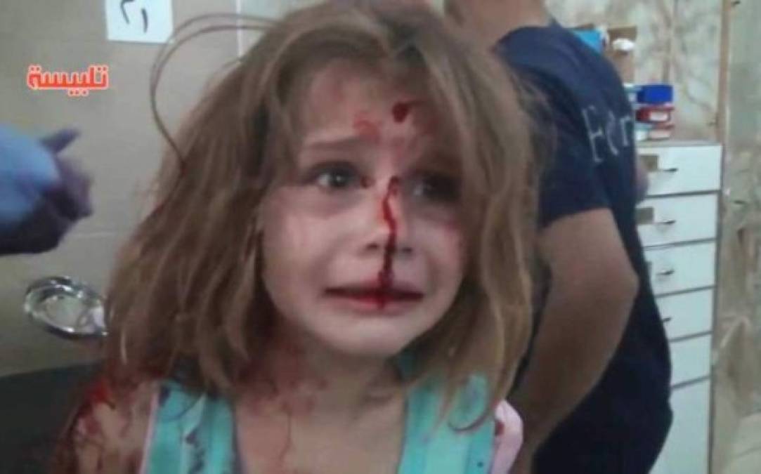 Las imágenes de una niña siria herida y llorando desesperadamente por su padre en la sala de emergencias de un hospital en Talbiseh, deja en evidencia el drama que se vive por la guerra en Siria.