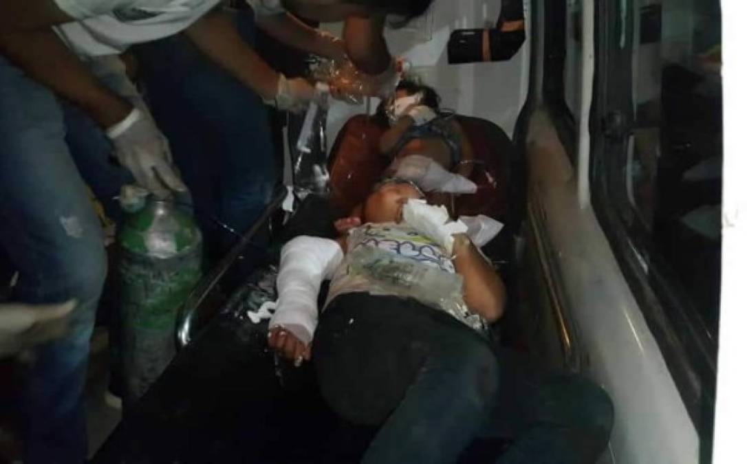 Otras nueve personas, entre adultos y niños, resultaron con heridas graves, informaron las autoridades de la Policía Nacional.