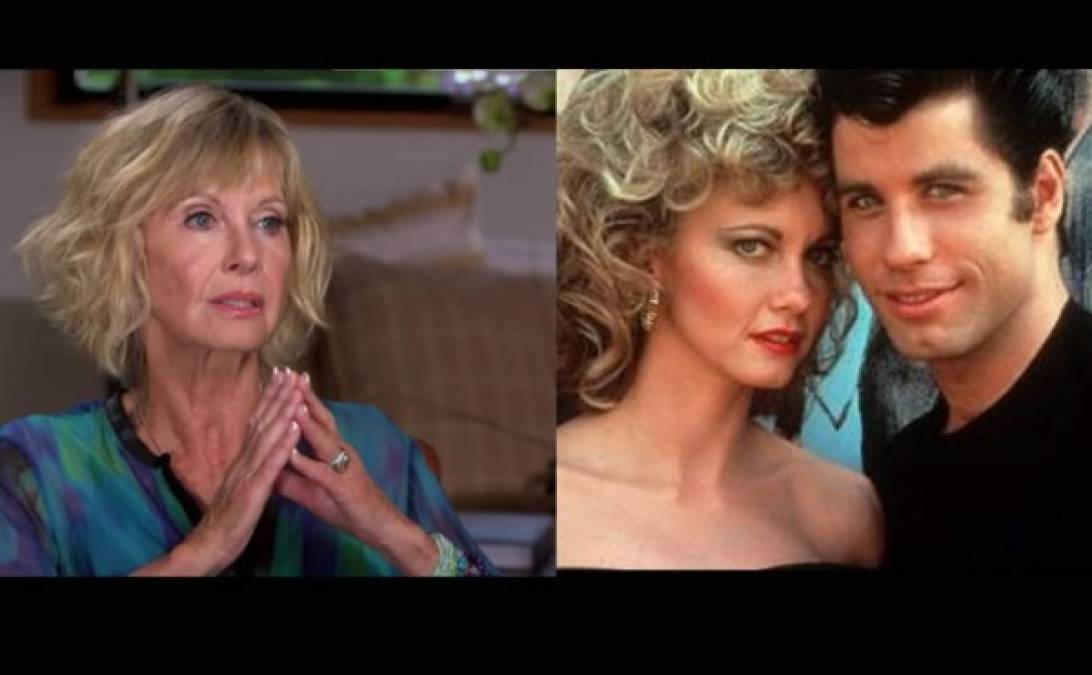 Olivia Newton-John<br/>La protagonista de Vaselina venció al cáncer de mama en 1992 y también en 2013, cuando regresó en su hombro, pero en 2018 confirmó que le había vuelto por tercera ocasión, ahora en la columna vertebral. En su tratamiento mezcla medicina moderna y terapias naturales.<br/>