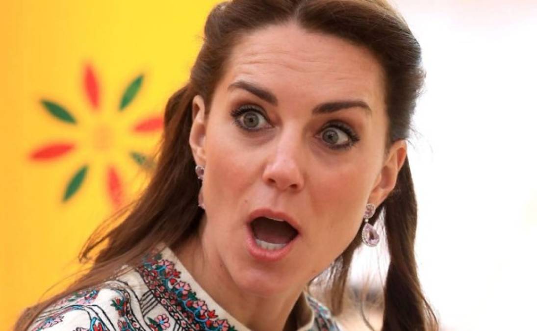 Un cirujano del Reino Unido ha señalado a la duquesa de Cambridge, esposa del príncipe William, por sus supuestos retoques estéticos y lo mostró con imágenes, lo que generó la reacción de la realeza.