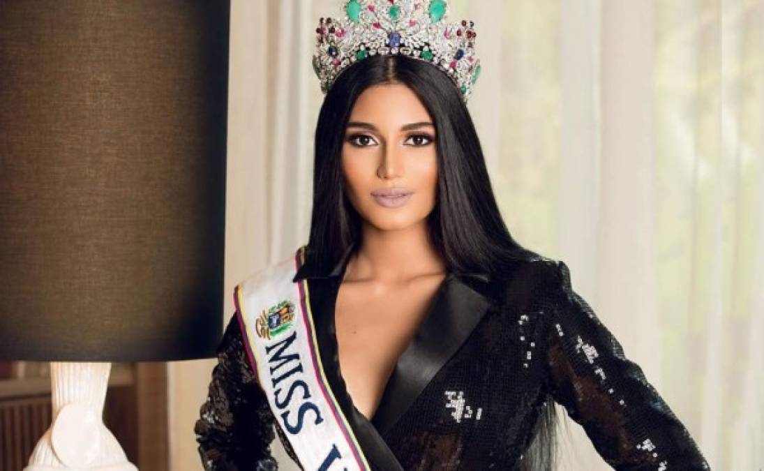 Después de quedar como la segunda finalista en el Miss Universo 2018 las redes sociales se han encargado de desempolvar antiguas fotos de la reina de belleza en donde luce bastante cambiada a su aspecto actual y hasta se podría decir que ha recibido ayuda del bisturí.