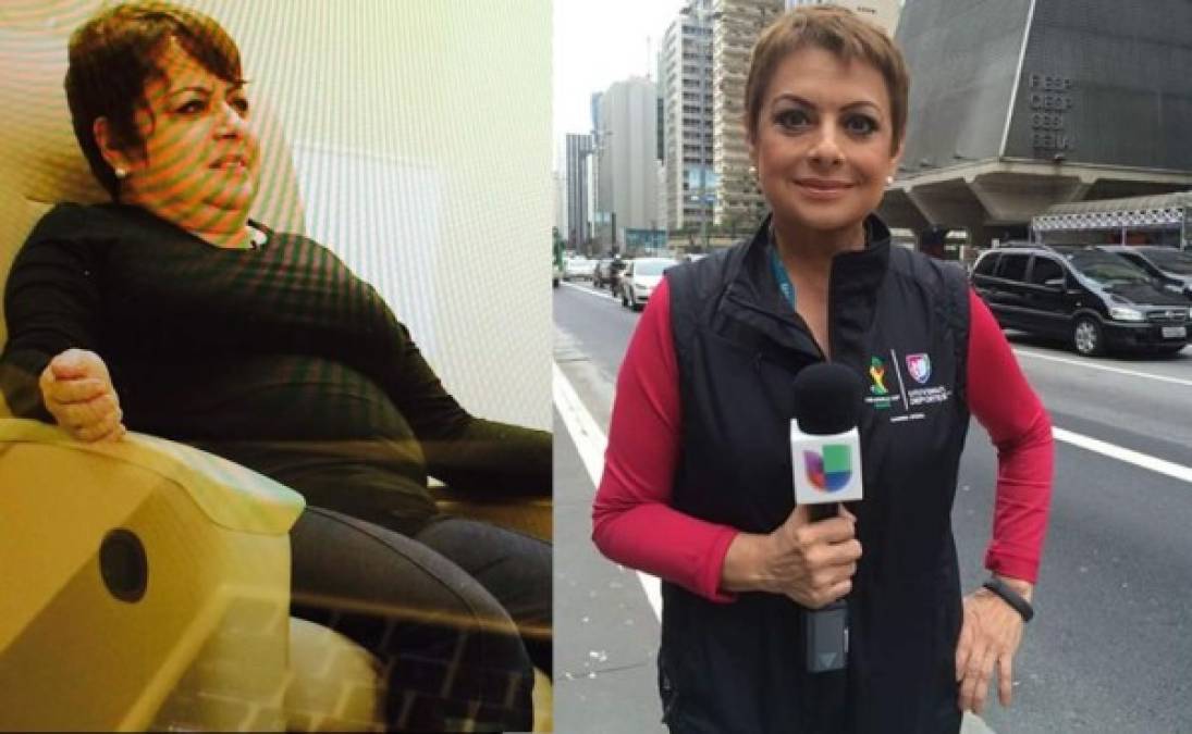 María Antonieta Collins perdió más de 70 libras luego de una operación que le hicieron pequeño su estómago.