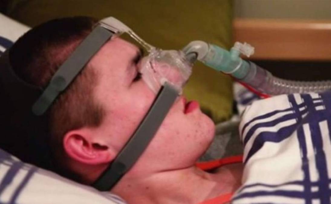 Liam Derbyshire es un joven del Reino Unido que se ha convertido en noticia a nivel mundial por su extraño padecimiento. El joven nació con el síndrome de hipoventilación central congénita, por lo que los doctores le dieron muy poco tiempo de vida después de nacer. Derbyshire cumplirá 18 años a pesar de que se le dio menos de seis semanas de vida por su enfermedad. Según la BBC, en todo el mundo unas 1,500 personas padecen esta rara enfermedad, que se trata de un fallo congénito que afecta al sistema nervioso central y autónomo. Esta enfermedad no permite que Liam se quede dormido ya que dejaría de respirar y moriría.