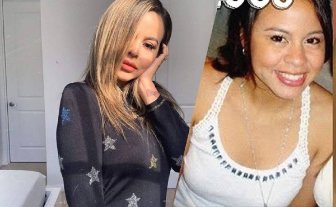 Al parecer la hondureña Ana Alvarado sucumbió a la presión de la 'perfección' que predican muchos influencer en Instagram.<br/><br/>La catracha recurrió a las cirugías plásticas para mejorar su aspecto físico no con uno sino con tres procedimientos estéticos, y estos solo son los más recientes.<br/>