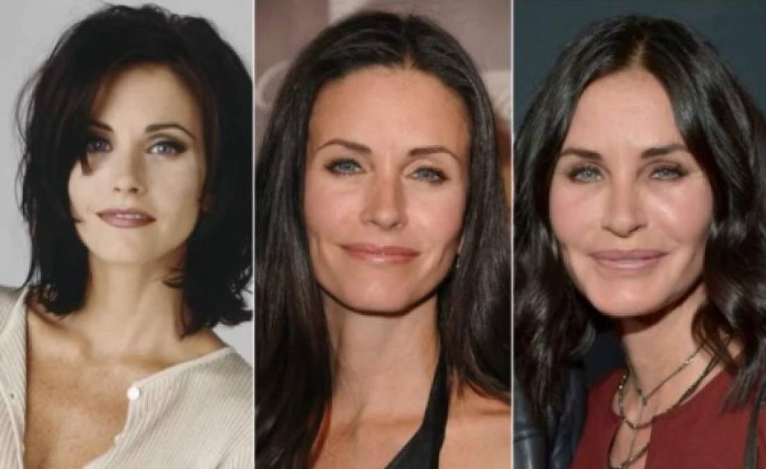 Courteney Cox: Decidió sucumbir a los “encantos” de la cirugía y el bótox, lo que provocó falta de expresividad en su rostro y durante varios años dejó de ser una chica sencilla y fresca. Ahora luce un rostro natural y acorde a su edad.