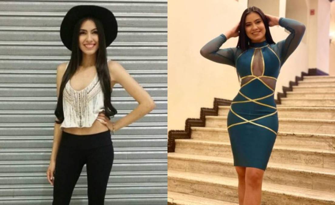 La presentadora Alejandra Rubio de ¡Qué hubo Chano! admitió en un programa de tv que se había aumentado los pechos, también indicó que sus glúteos eran naturales. Aquí las fotos del antes y después.