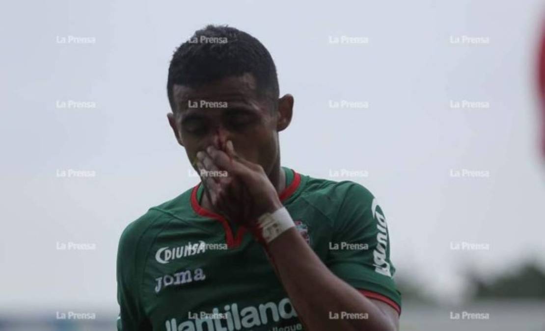 El lateral izquierdo del Marathón Samuel Chama Córdova salió en ambulancia del estadio Yankel Rosenthal tras sufrir, al parecer, una fractura en la nariz.