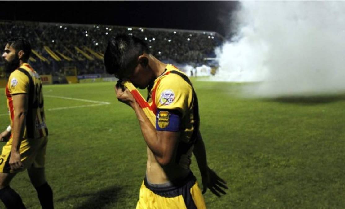 Edder Delgado, capitán del Real España, afectado por el gas lacrimógeno.