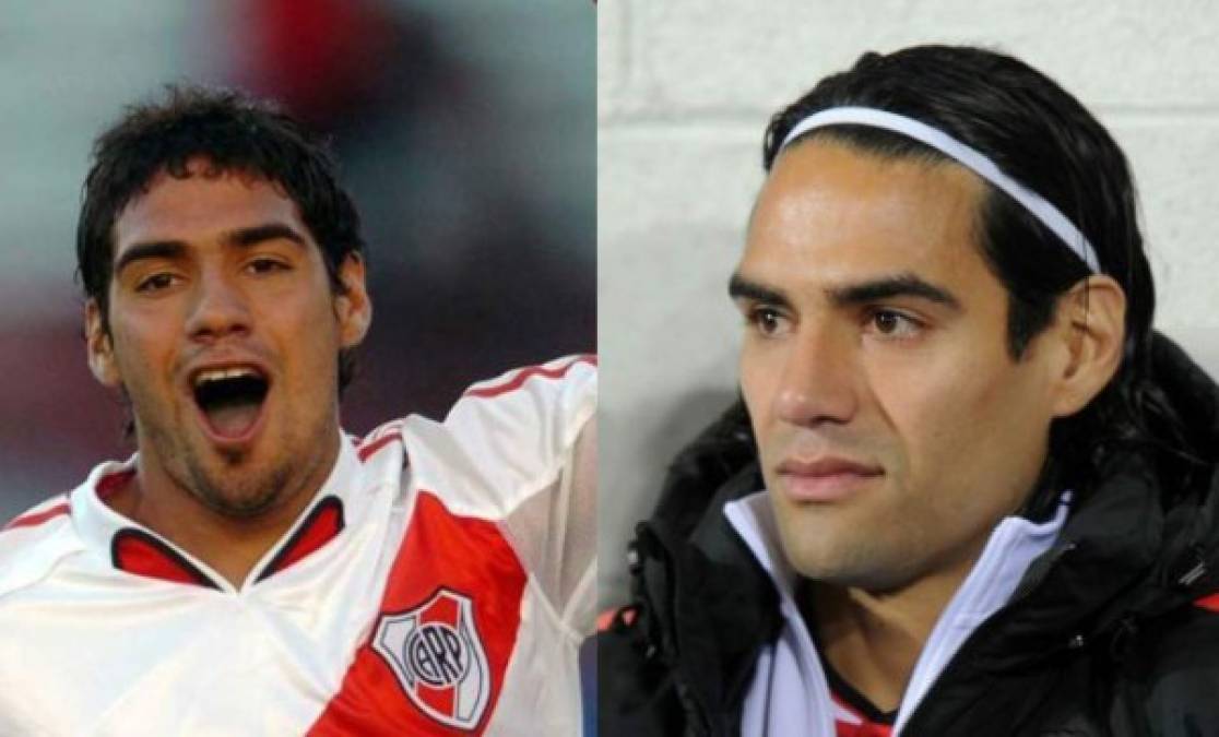 Radamel Falcao, también ha pasado por el quirófano y ahora luce una nariz totalmente diferente a la de hace un tiempo.