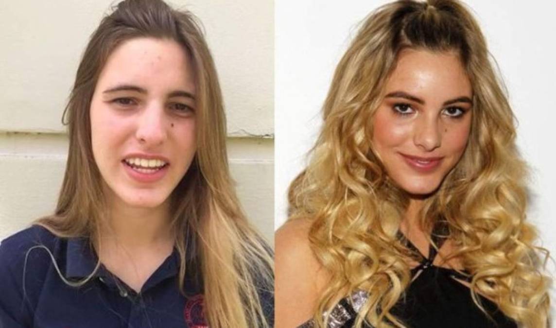 Lele Pons no oculta que se ha sometido a retoques estéticos para mejorar su físico. En el pasado ella misma se ha encargado el cambio.