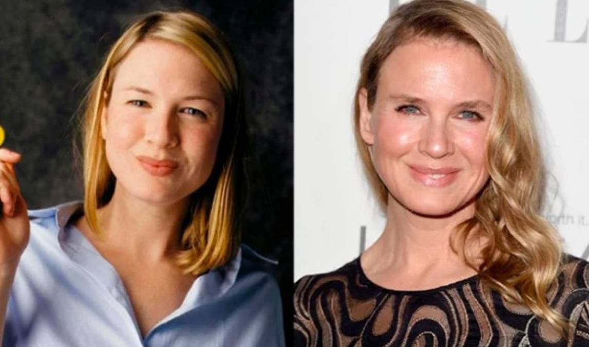 Renée Zellweger<br/><br/>No se ve mal, pero su rostro ha sido transformado por las cirugías. <br/>