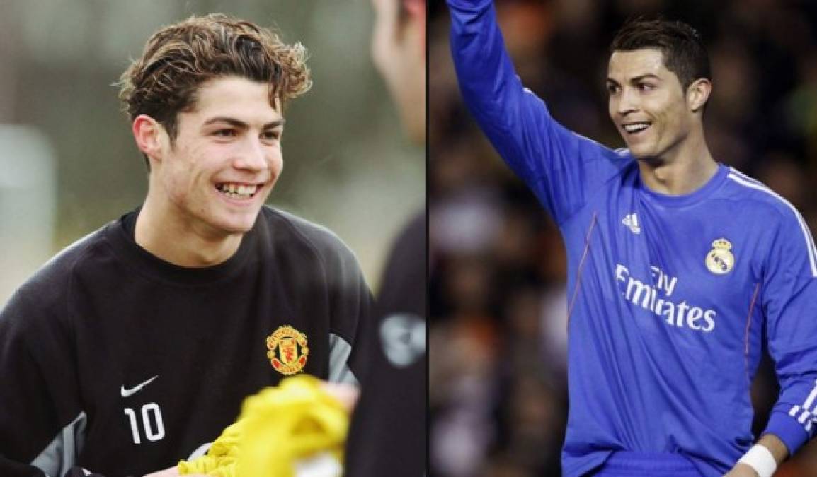 Cristiano Ronaldo es uno de los que ha tenido que acudir al bisturía, así era antes cuando estaba joven en el Manchester United, se nota la diferencia.