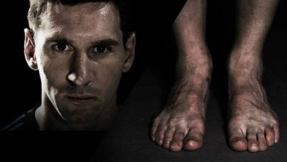 El crack argentino Lionel Messi se una a la lista de los futbolistas que tienen pies feos.