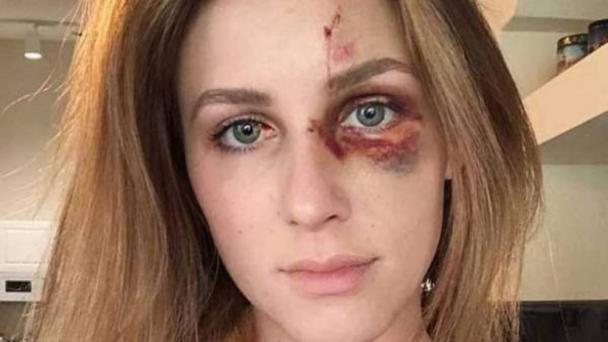 La chica ha impactado al mostrar como quedó su rostro tras los golpes que recibió por parte de su novio.