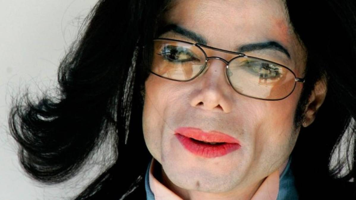 18. A pesar de que pocos le creyeron, el cantante explicitó el motivo: el vitiligo, una enfermedad sin tratamiento que despigmenta la piel. <br/><br/>19. Se llegó a decir que dormía en una cámara de oxígeno para evitar su deterioro, rumor que la estrella no tardó en desmentir.<br/><br/>20. Familiares y amigos más cercanos no lo veían y dudaban de que pudiera sobrellevar el estrés de lo que iba a ser This Is It.