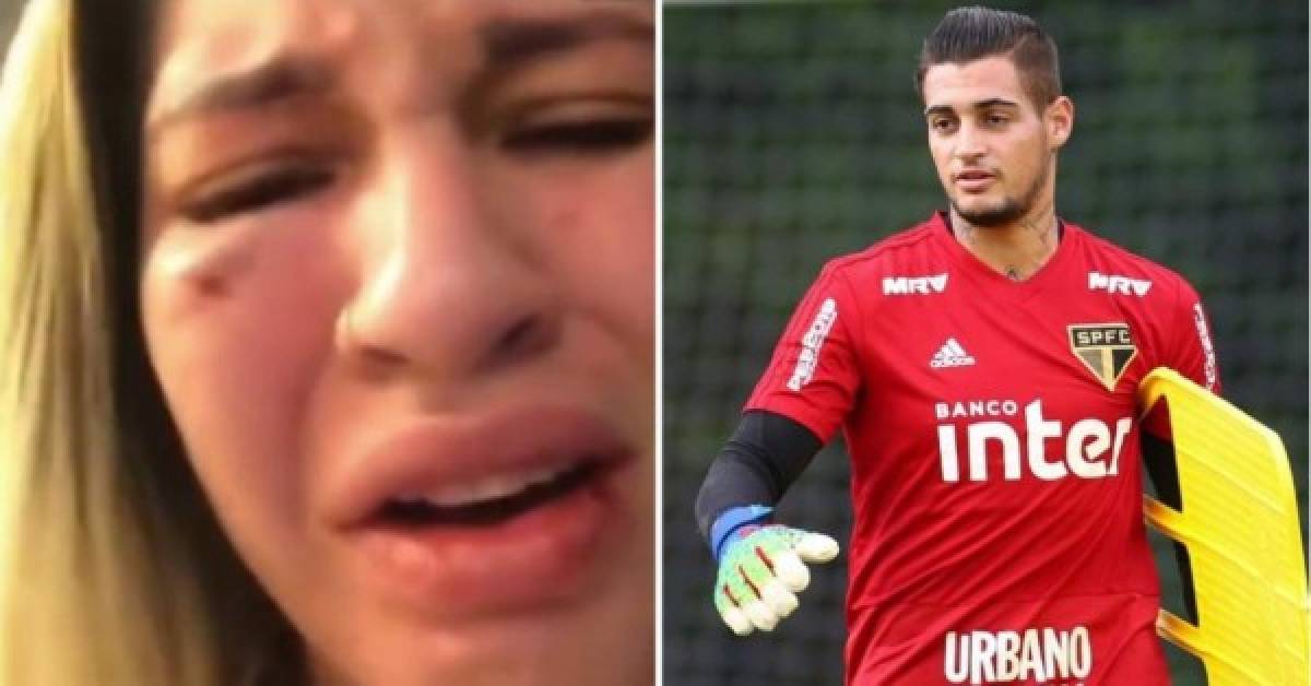 Milena Bemfica, entonces esposa del jugador Jean Paulo Fernandes Filho publicó en stories de su cuenta de Instagram videos de su cara con golpes.