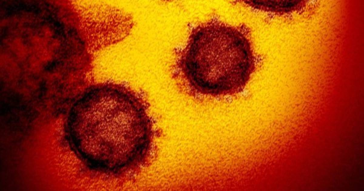 Una lista de supuestos consejos sobre cómo detectar y tratar el nuevo coronavirus circula ampliamente en redes sociales. AFP Factual entrevistó a especialistas y consultó las recomendaciones de diversas autoridades sanitarias, y la gran mayoría de estos consejos se basan en afirmaciones falsas o sin fundamento científico.<br/><br/>A continuación un resumen de las principales afirmaciones que se hacen en ese mensaje.