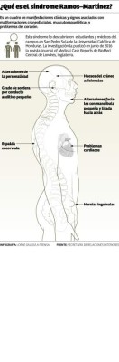 Médicos hondureños descubren síndrome único en el mundo