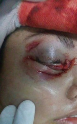 Mujer pierde ojo derecho tras bestial golpiza de su marido