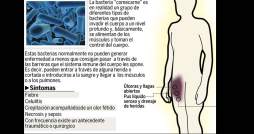 Ya suman tres las víctimas mortales por bacteria 'comecarne'