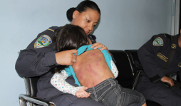 Honduras: Padrastro le asesta brutal golpiza a niña de 2 años