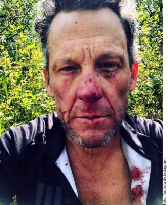 El ex ciclista Lance Armstrong sufrió una aparatosa caída y la presume en Instagram