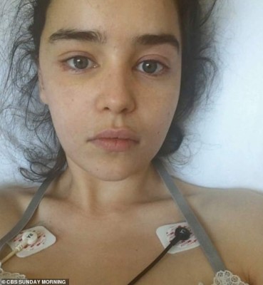 Emilia Clarke comparte fotos inéditas de su hospitalización tras aneurisma cerebral