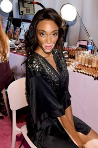 Habrán rostros nuevos, ya que habrá 18 modelos que debutaran en el show de Victoria’s Secret.<br/><br/>Entre ellas, Kelsey Merritt, la primera modelo filipina que desfila para VS, y Yasmin Wijnaldum, la holandesa que con solo 19 años desfiló para Prada. <br/><br/>También veremos a Winnie Harlow (en foto), la modelo con vitíligo del momento, y la gran sorpresa, Behati Prinsloo volverá a lucir las alas después de dejarlas en 2015 para ser madre.<br/>