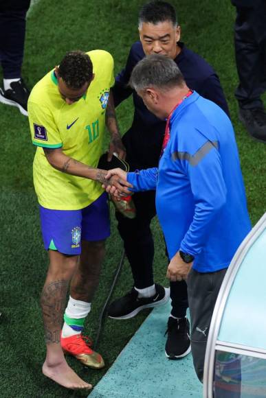 Neymar terminó con el tobillo derecho inflamado. 
