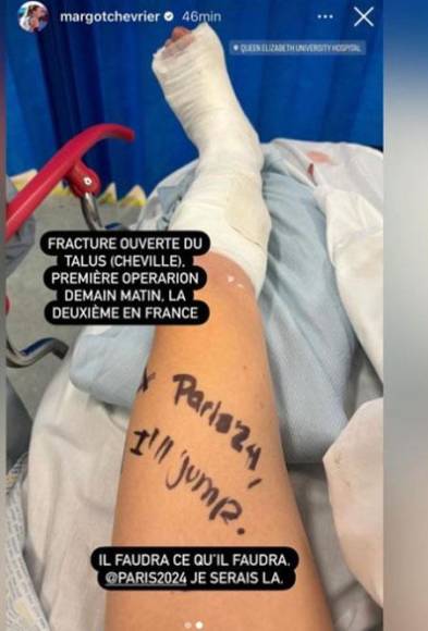 Chevrier compartió en Instagram una actualización sobre su estado, incluida una fotografía de su tobillo enyesado, prometiendo a sus seguidores su participación en París 2024 a pesar de los obstáculos