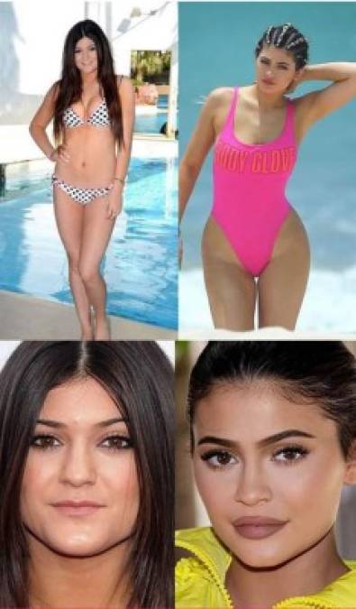 <a href='https://www.laprensa.hn/fotogalerias/1097525-411/la-transformacion-kylie-jenner-en-la-ultima-decada?page=1' style='color:red;text-decoration:underline' target='_blank'> Kylie Jenner se habría hecho una rinoplastia, aumento de glúteos y caderas</a> ; aumento de busto y engrosamiento de labios, aunque esta parte, así como sus tratamientos para cambiar el tono de su piel, sí fue admitida por la celebridad.