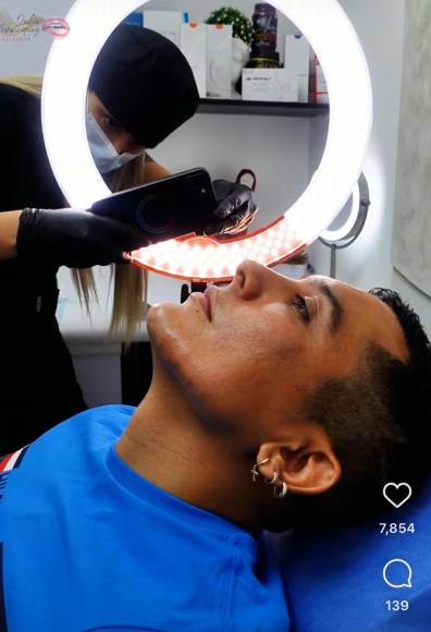 El cantante Edwin Luna causó revuelo en las redes al someterse a nuevos procedimientos estéticos. A través de un video en Instagram, el líder de la Trakalosa de Monterrey mostró los cambios que se realizó, incluyendo una perfilación de nariz y mandíbula.