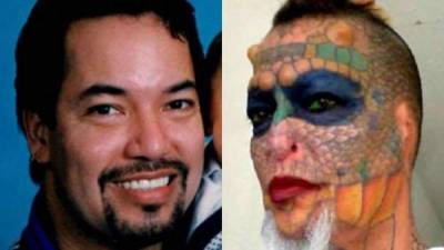 Fotografía del antes y después de Richard Hernández. Fotos cortesía de 24Horas.cl