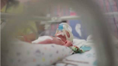 Ward Miles es un niño que nació prematuro con 15 semanas de anticipación y con un peso de tan solo 700 gramos.