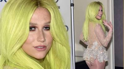 Este es el nuevo look de Kesha.