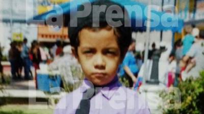 Selvin Pineda (8) no soportó la intervención quirúrgica.