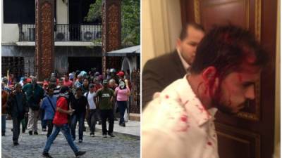 El diputado Armando Armas resulto herido debido a la violencia desatada dentro de la Asamblea Nacional Venezolana.