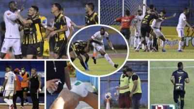 Las imágenes del clásico del fútbol hondureño que empataron Real España y Olimpia (1-1) en el inicio del Torneo Apertura 2020-2021 de la Liga Nacional. Fotos Yoseph Amaya y Neptalí Romero