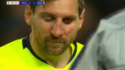Messi se llevó un duro golpe en el rostro y terminó sangrando.
