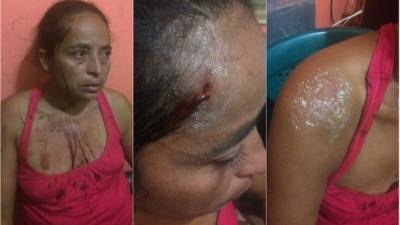 La mujer agredida se refugió en la casa algunos vecinos.