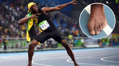 Usain Bolt dejó ver el aspecto de sus pies.