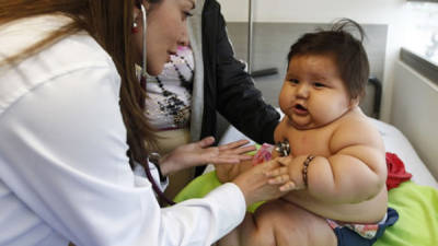 Bebé de ocho meses que pesa más de 20 kilos atrajo la atención de los medios colombianos.