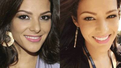 El antes y después de la sonrisa de Nathalia Casco.