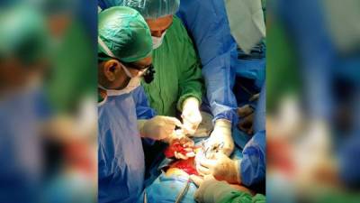 El equipo de médicos cuando realizaban el primer trasplante renal a una niña de 12 años la semana pasada.
