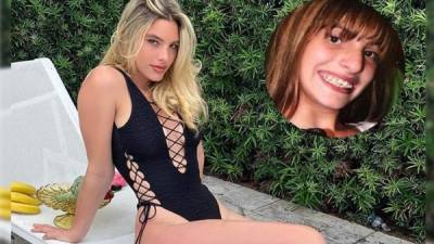 El cirujano plástico Dr. Kassir publicó varias fotos del antes y después de Lele Pons en el marco del 24 cumpleaños de la famosa venezolana.