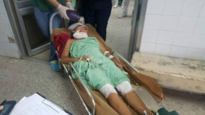 Iris Araceli Sagastume de 11 años fue atropellada por un bus.