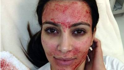 El popular facial vampiro fue puesto en boga por celebridades como Kim Kardashian.