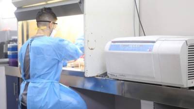 Imagen de archivo de un trabajador de laboratorio en el departamento de Cortés.